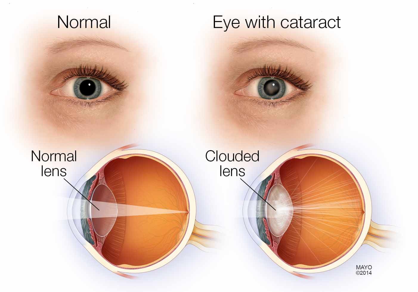 best cataract surgery in Ayodhya Cantt,best cornea & refractive treatment in Ayodhya Cantt,best dry eye treatment in Ayodhya Cantt,best eye clinic in Ayodhya Cantt,best eye clinic in janana hospital road,     best eye doctor in Ayodhya Cantt,best eye hospital in Ayodhya Cantt,best eye specialist in Ayodhya Cantt,best eye specialists in Ayodhya Cantt,best eye surgeon in Ayodhya Cantt,best eye surgery specialist in Ayodhya Cantt, best glaucoma treatment in Ayodhya Cantt,