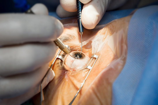 best cataract surgery in Ayodhya Cantt,best cornea & refractive treatment in Ayodhya Cantt,best dry eye treatment in Ayodhya Cantt,best eye clinic in Ayodhya Cantt,best eye clinic in janana hospital road,     best eye doctor in Ayodhya Cantt,best eye hospital in Ayodhya Cantt,best eye specialist in Ayodhya Cantt,best eye specialists in Ayodhya Cantt,best eye surgeon in Ayodhya Cantt,best eye surgery specialist in Ayodhya Cantt, best glaucoma treatment in Ayodhya Cantt,